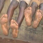africa feet